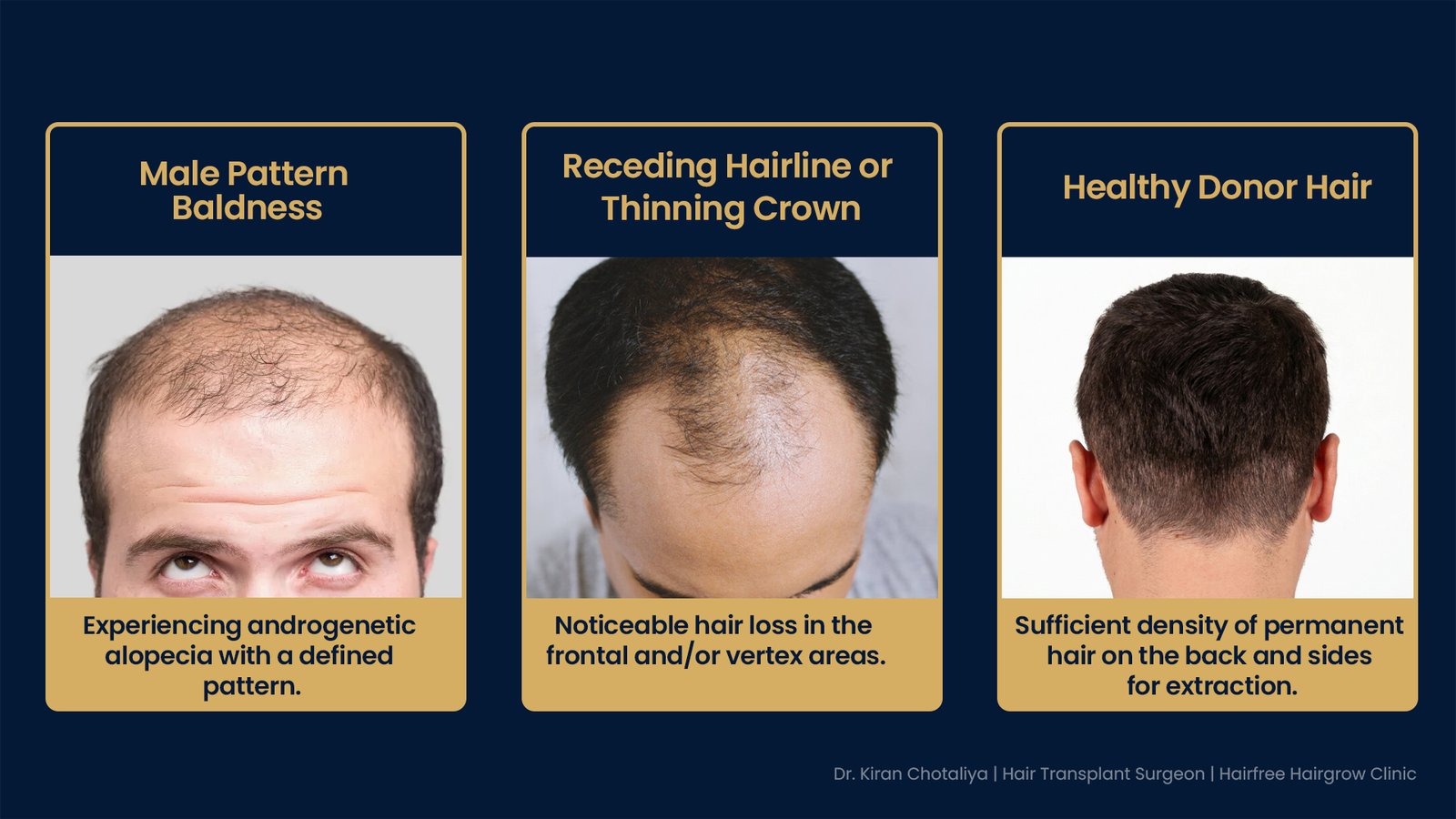 Ideal candidates for hair transplant in Pune including men with male pattern baldness, receding hairline, and healthy donor hair