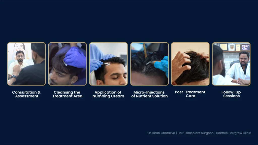 Mesotherapy Treatment for Hair Loss in Pune Showing Consultation, Scalp Preparation, Nutrient Injections and Follow-Up Care