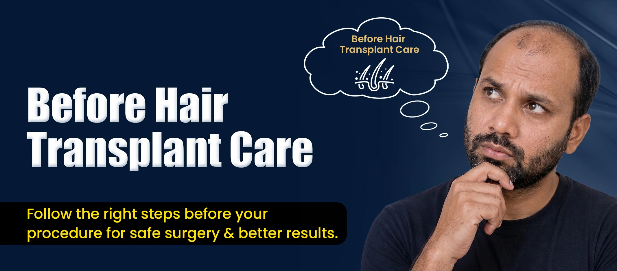 Before hair transplant care consultation in Pune with Dr. Kiran Chotaliya
