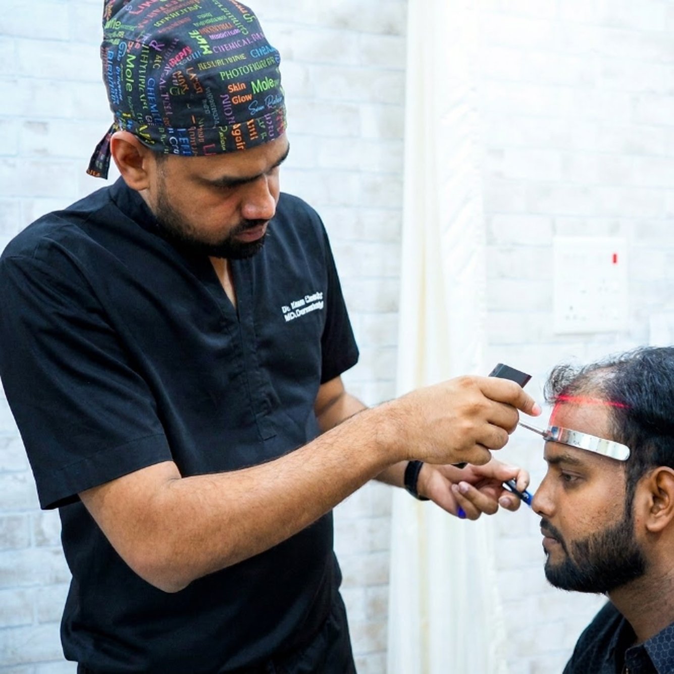 Hairline marking for hair transplant.