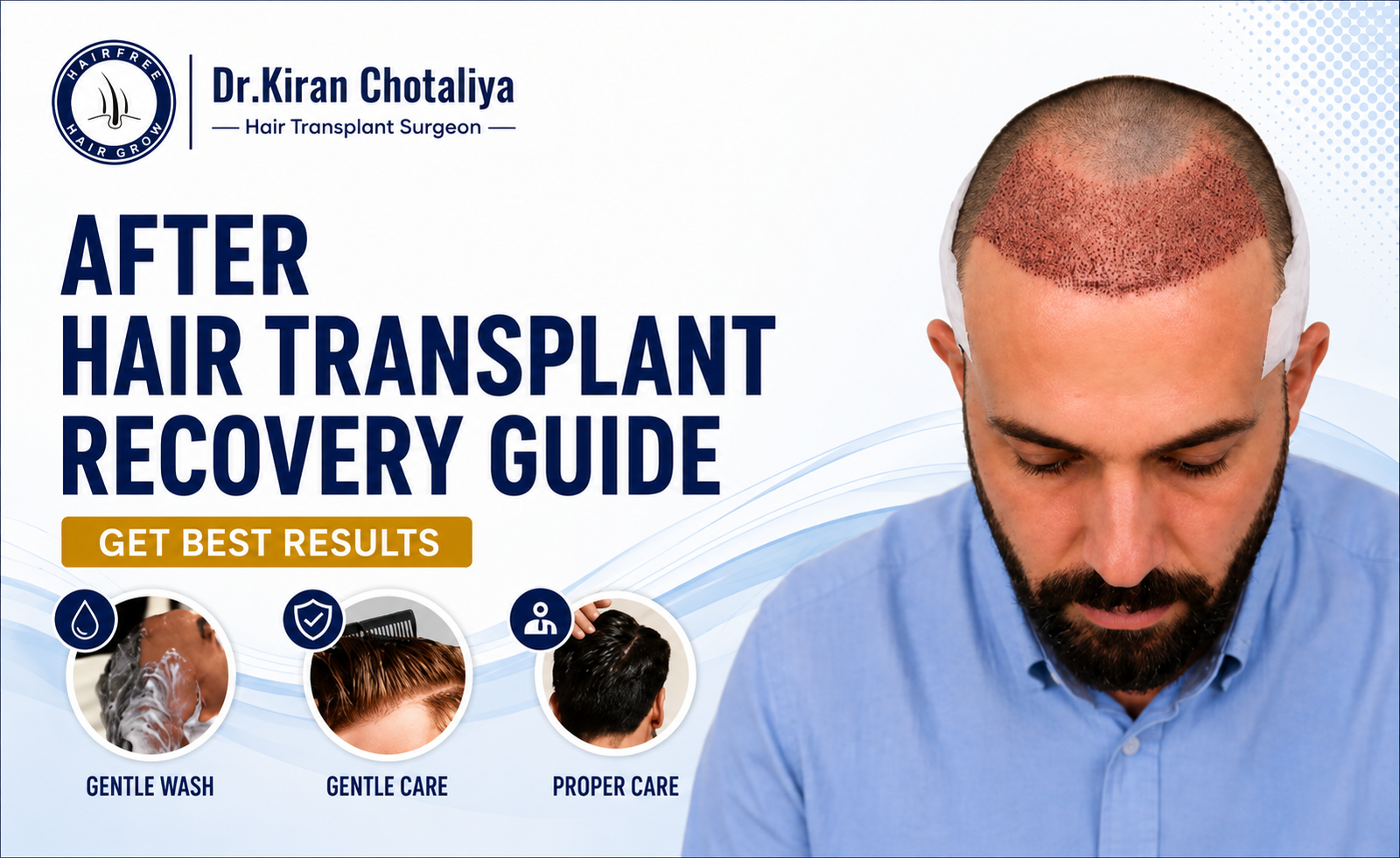 After Hair Transplant Recovery Guide Get Best Results