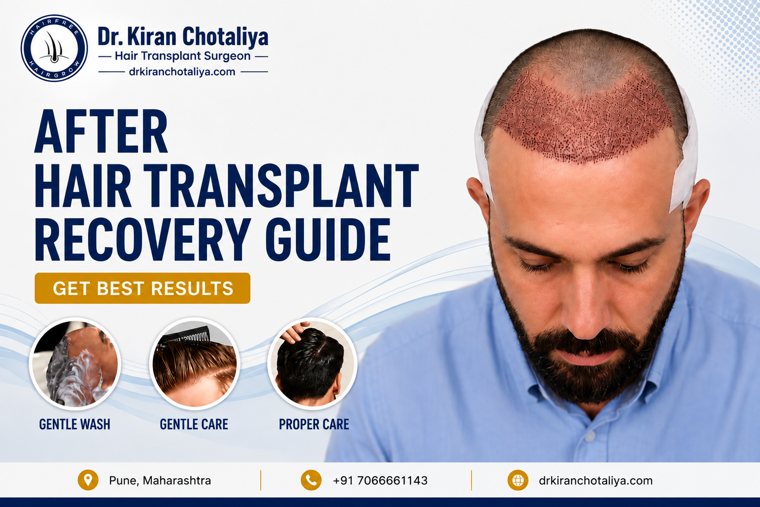 Hair transplant recovery guide by Dr. Kiran Chotaliya