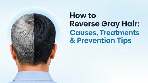 How to Reverse Gray Hair premature gray hair treatment causes of gray hair gray hair prevention tips treatment for gray hair