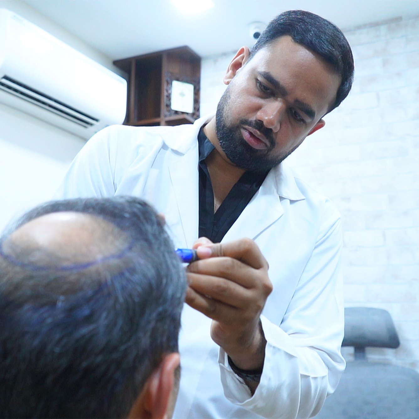 dr kiran chotaliya hair transplat treatment