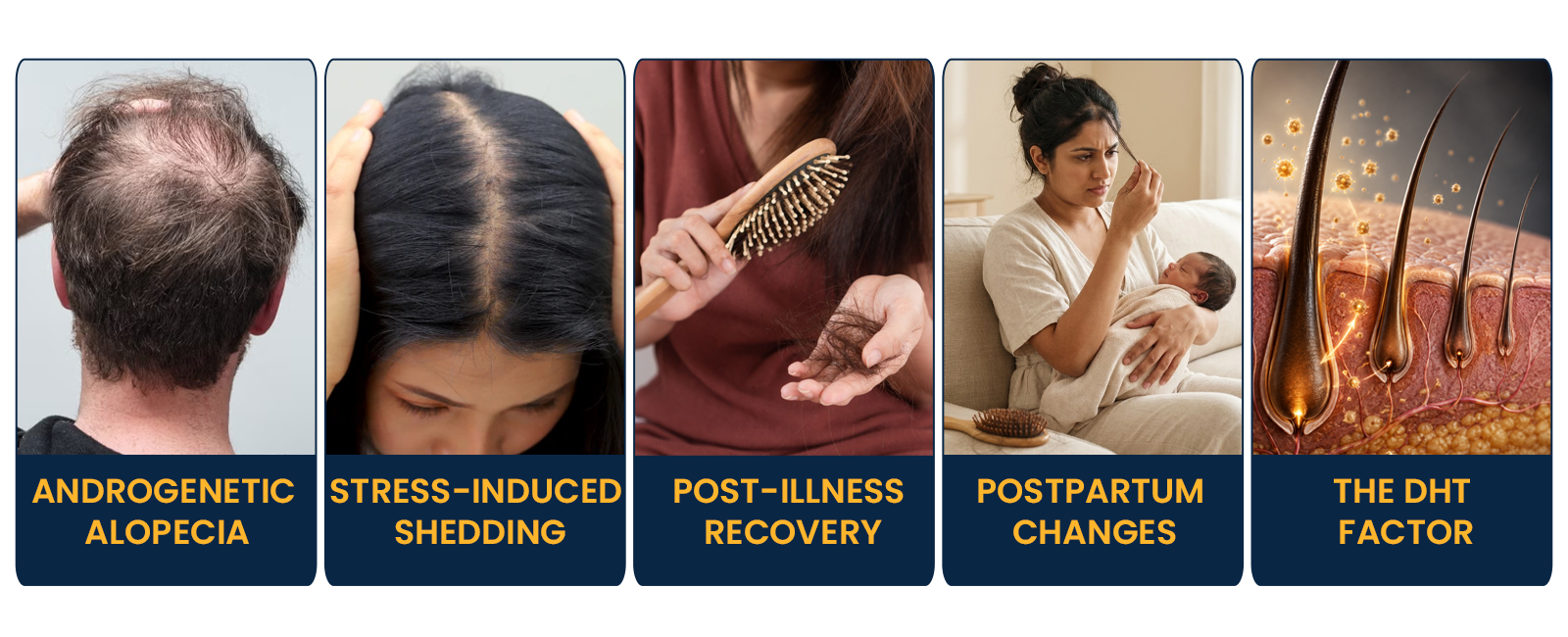 Common Causes of Hair Loss Addressed