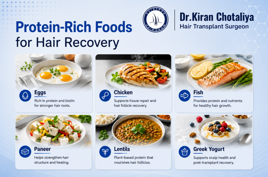 What Should I Eat After a Hair Transplant